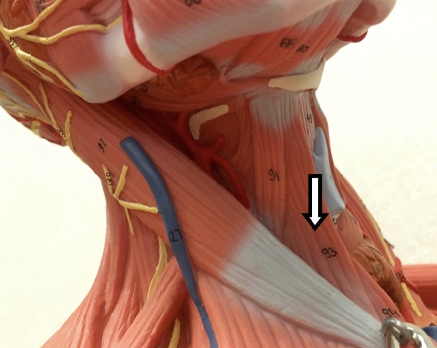 <p><span>Name the muscle labeled with the white arrow below:</span></p>