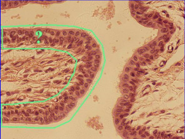 term image