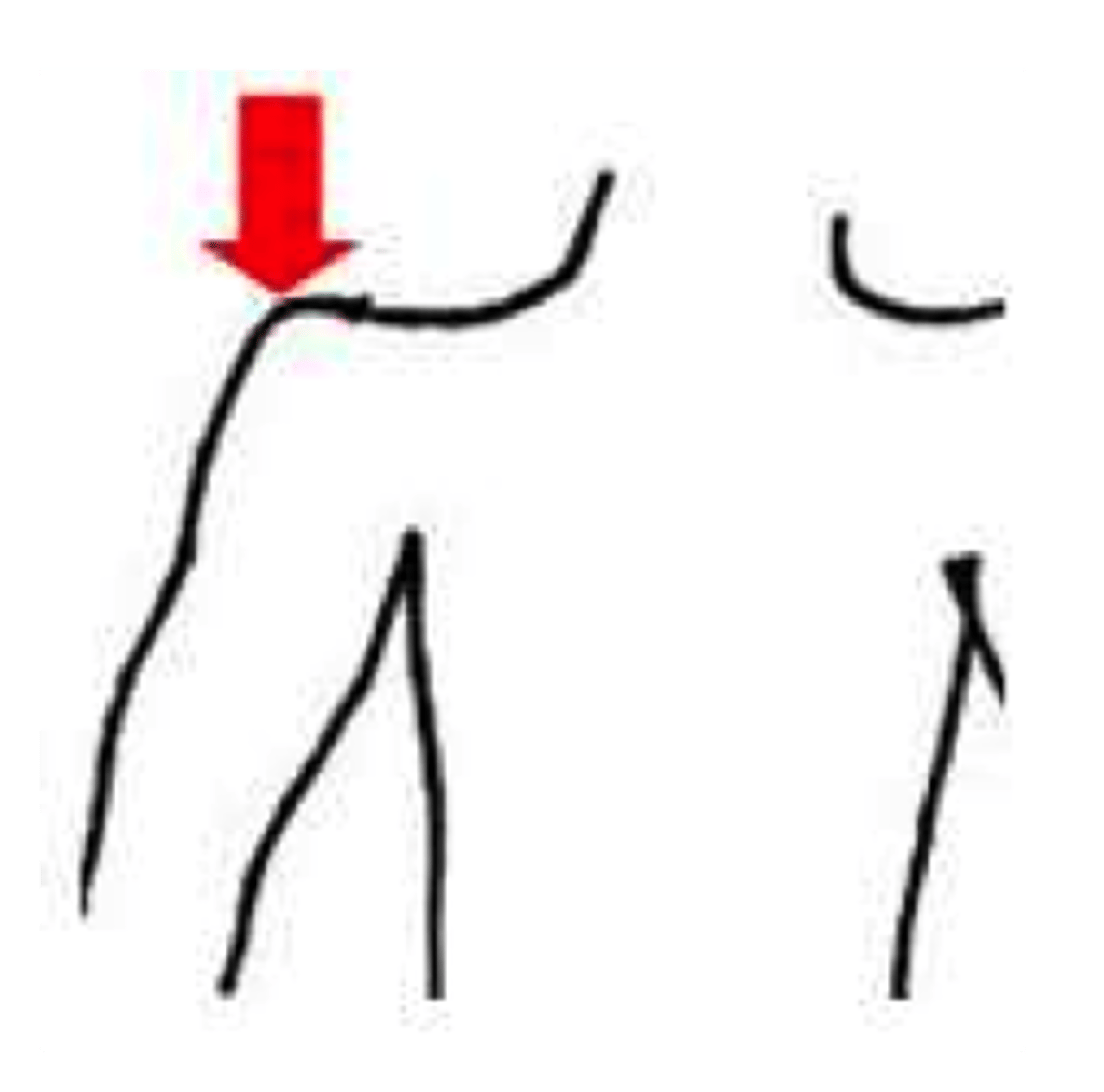<p>a shoulder</p>