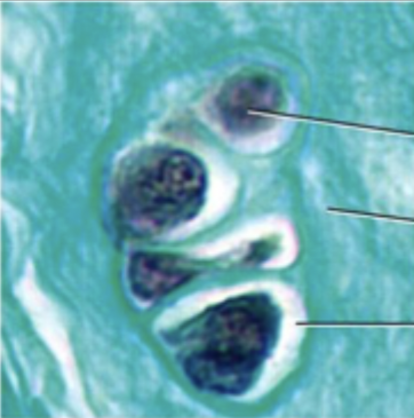 <p>chondrocytes in lacunae, collagen fibres in ground substance, fewer chondrocytes, chondrocytes aligned in rows</p>