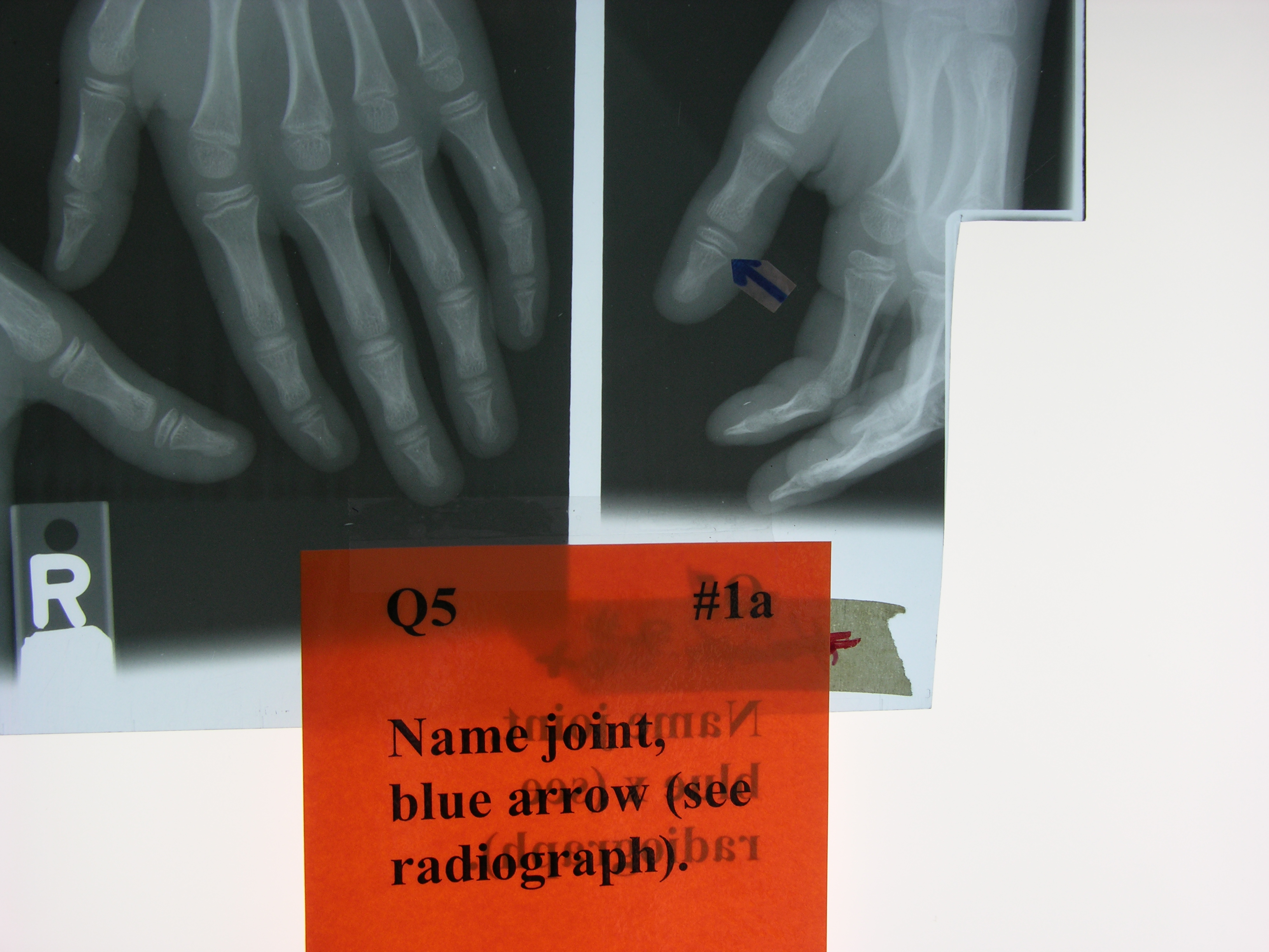 <p><span style="font-family: Lato Extended, Lato, Helvetica Neue, Helvetica, Arial, sans-serif; color: rgb(45, 59, 69)">Name the joint class ndicated by the blue arrow - use Latin.</span></p>