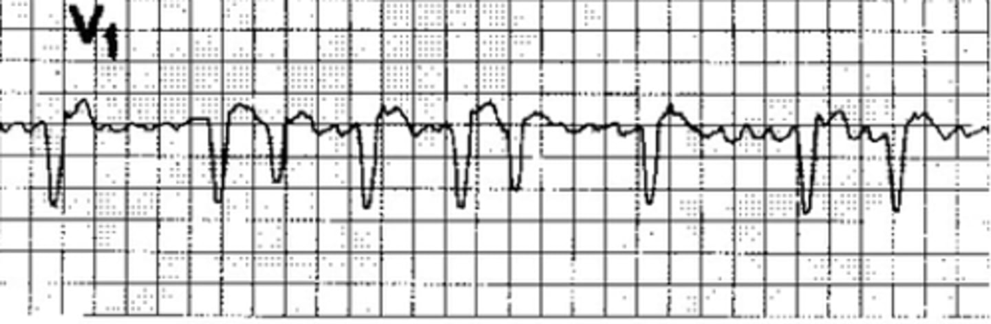 <p>(adj.) Stopping and beginning again, sporadic.</p><p>(SYN: fitful, spasmodic, random)</p><p>(ANT: uninterrupted)</p>
