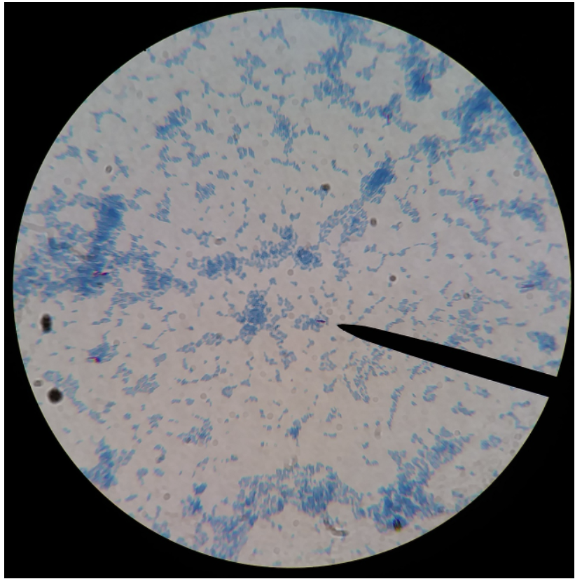 <p>What type of stain is this?</p>