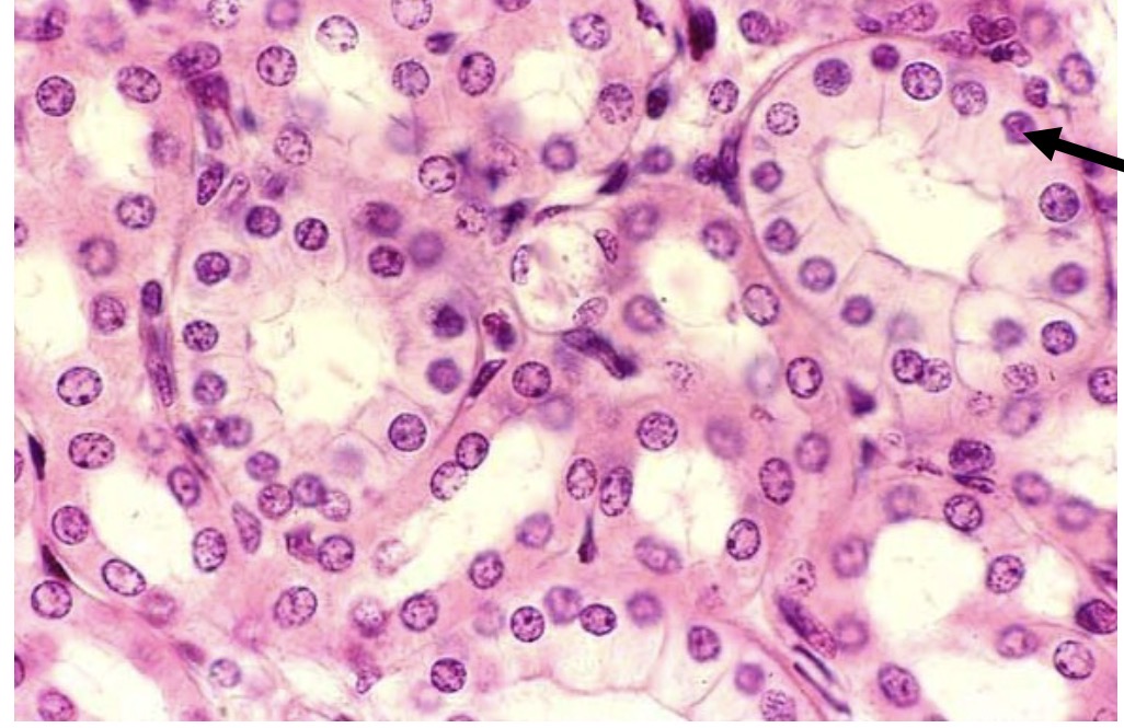 <p>Identify the type of tissue and the<br>structure at the arrow</p>