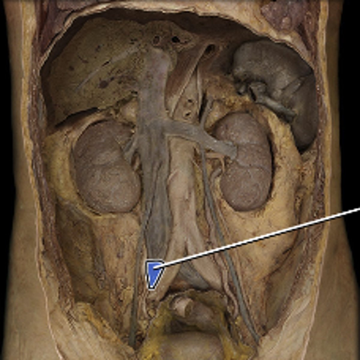 <p>drains blood from pelvic walls, pelvic viscera and lower limb</p>