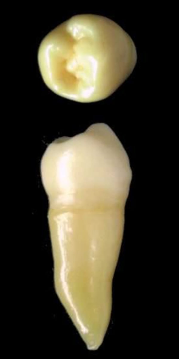 <p>what tooth is this &amp; why?</p>