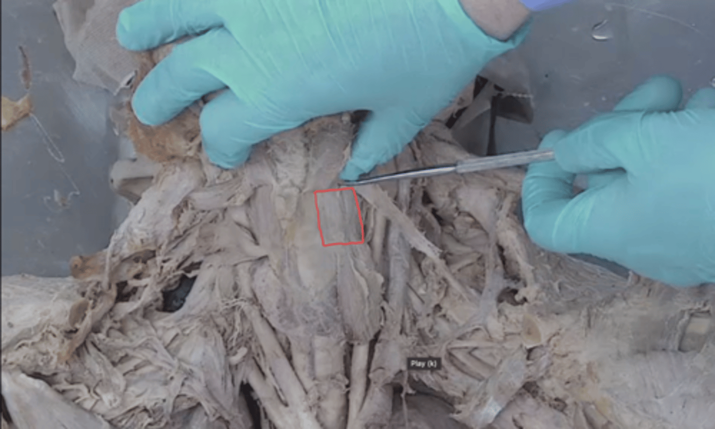 <p>identify this muscle (sternohyoid muscle reflected)</p>