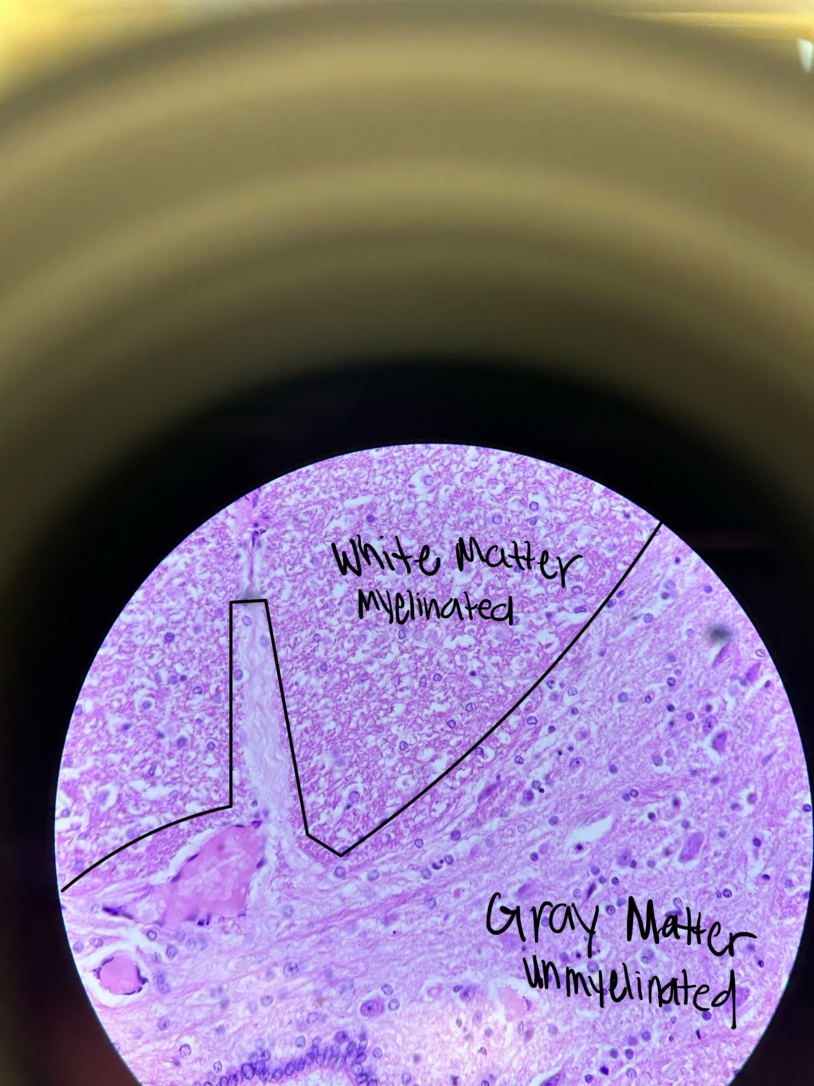 <ul><li><p>grey: unmyelinated cell bodies of neurons, neuroglia (inside of spinal cord, outside of brain stem)</p></li><li><p>white: myelinated axons, neuroglia (outside of spinal cord, inside of brain stem)</p></li><li><p>spinal cord and brain stem </p></li></ul><p></p>