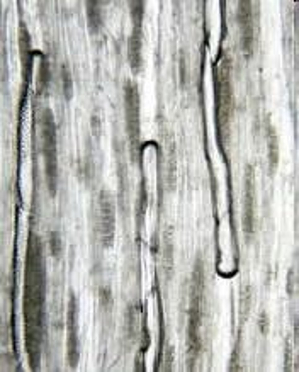 <p>They are dead at maturity, forming a pathway with reduced resistance for water movement.</p>