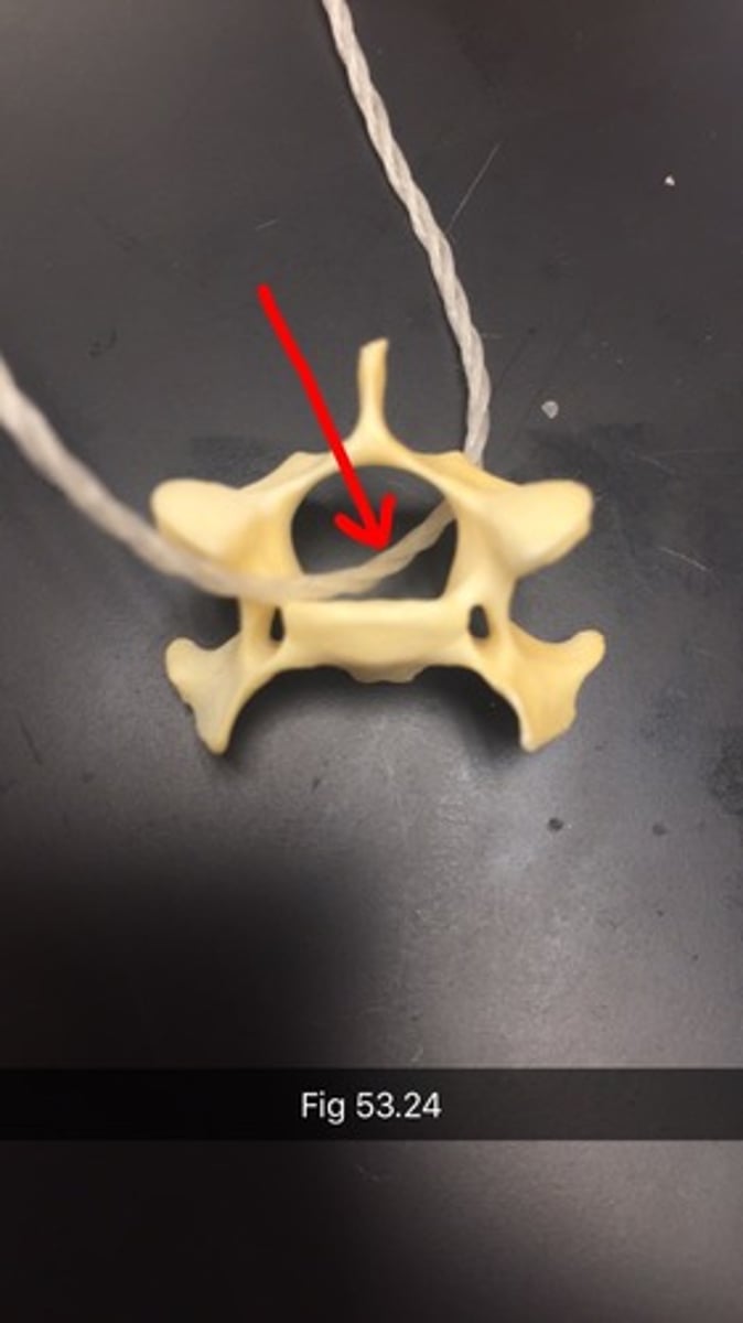 <p>The red arrow is pointing to the vertebral canal</p>