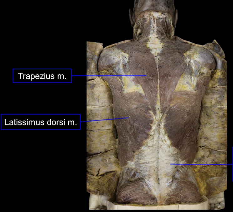 <p>Trapezius - upper, middle, lower</p><p>Latissimus dorsi</p>