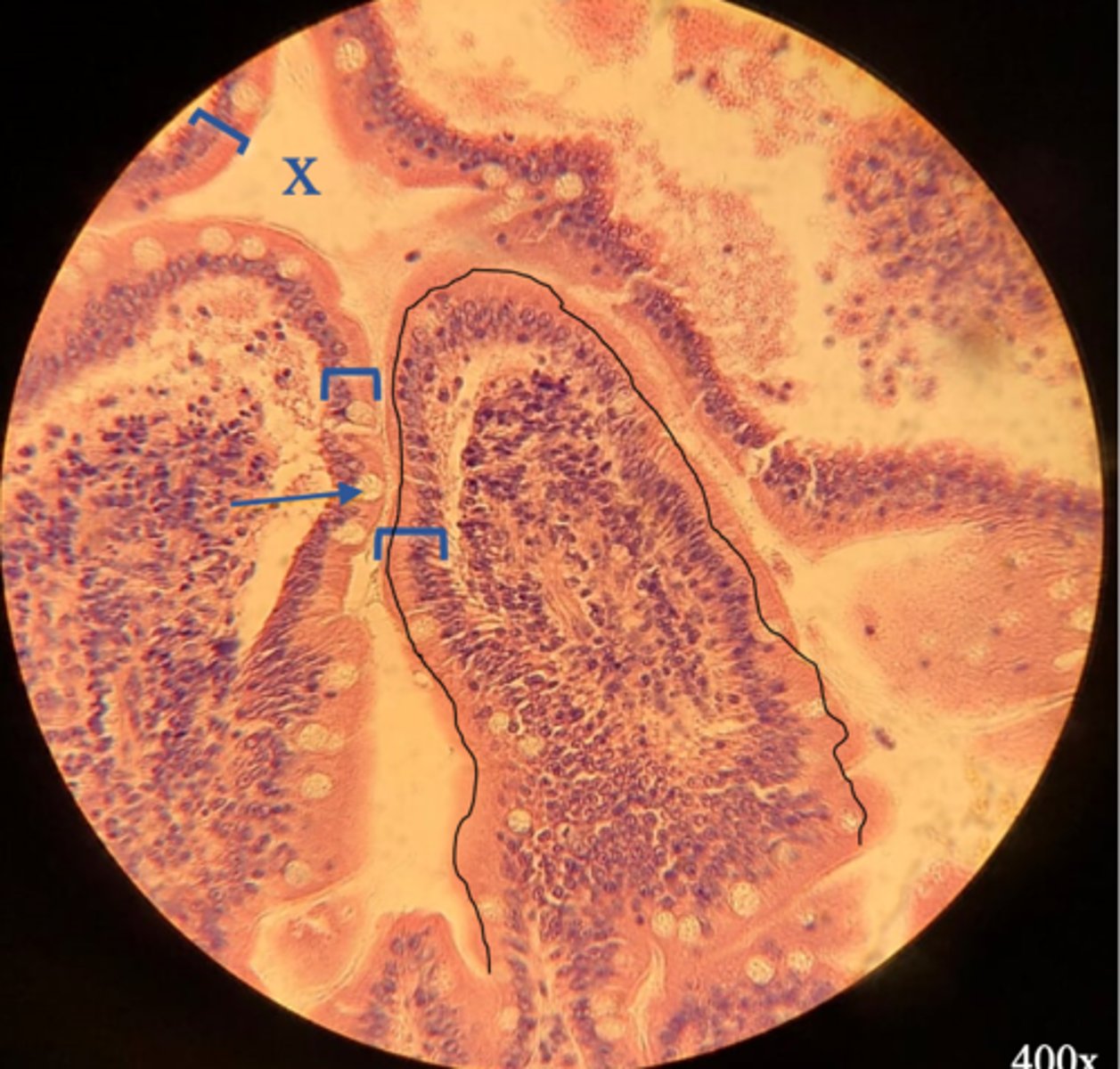 <p>Name the tissue bracketed.</p>