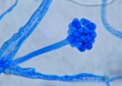 <p>Identify this fungus</p>