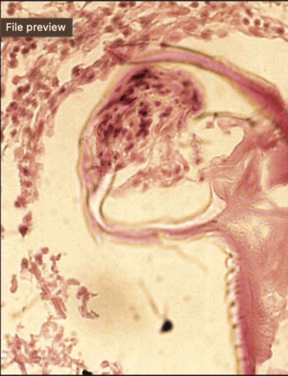 <p>What is this parasite? What characteristic/s did you use to identify it?</p>