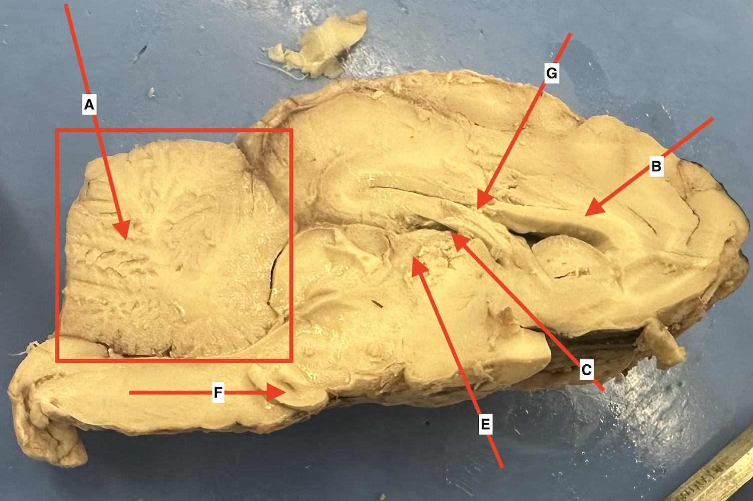 <p>Name the boxed in structure.</p>