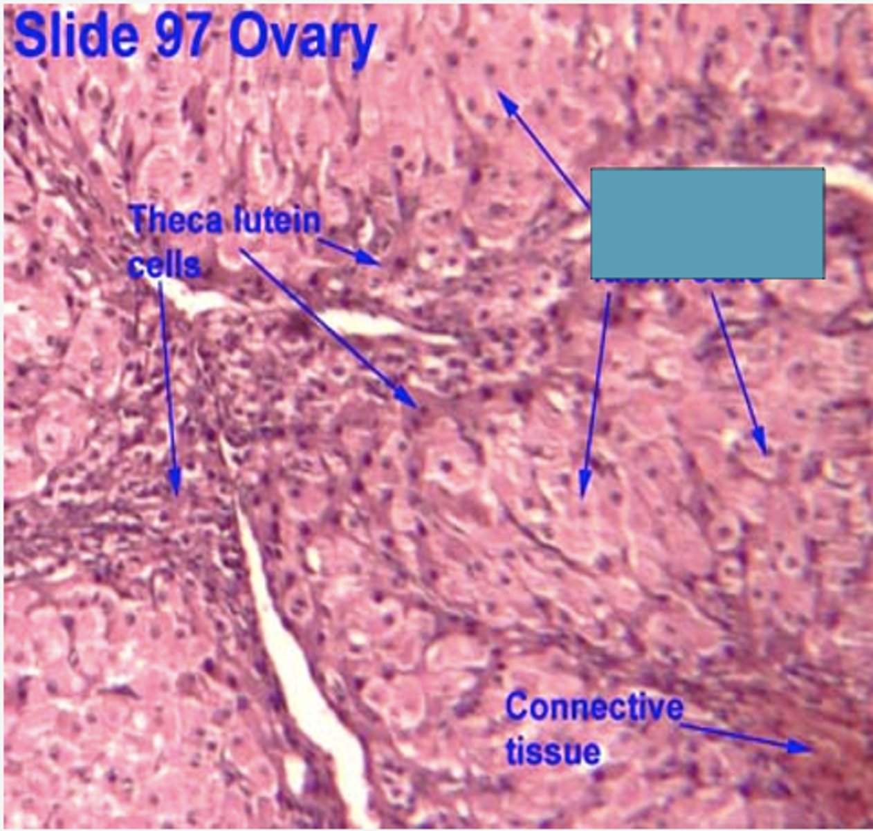 <p>Identify the cells</p>