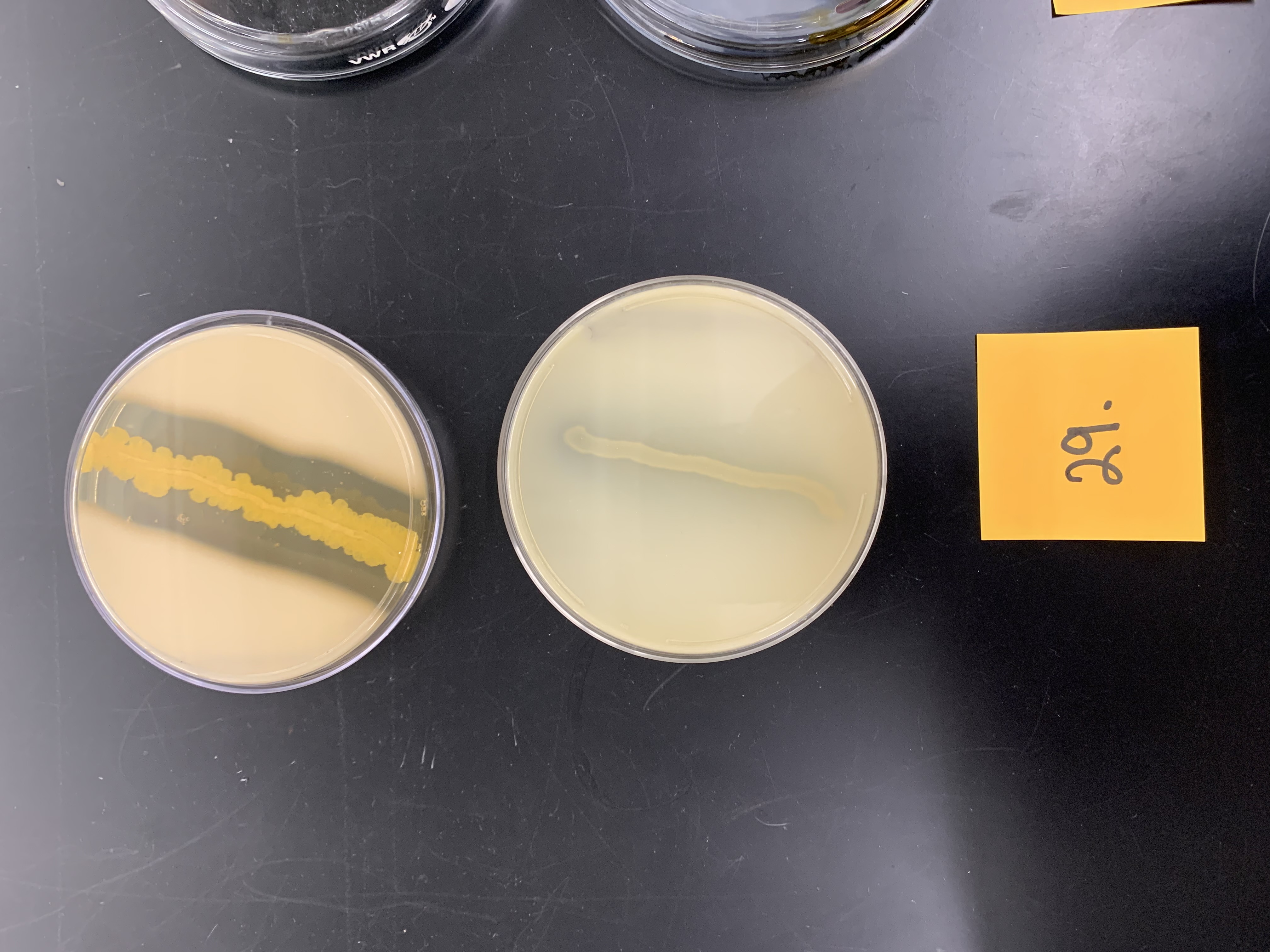 <p>skim milk agar; what enzyme is being tested</p>