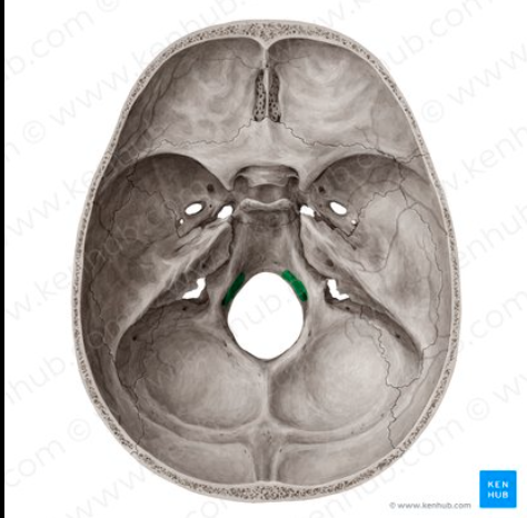 <p>What bone marking is this? <em>inside condyles</em>*</p>