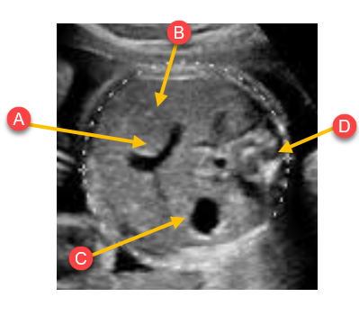 <p>Label the anatomy with the arrows</p>