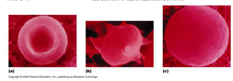 <p>Which red blood cell is under isotonic conditions?</p>