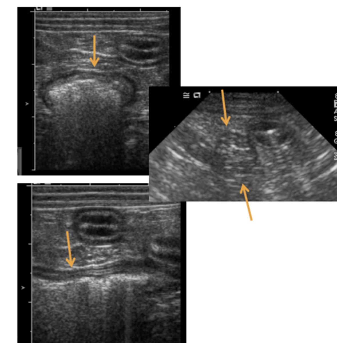 <p>what structure are these US images showing?</p>
