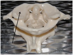 Name the entire top bone indicated by the arrow.