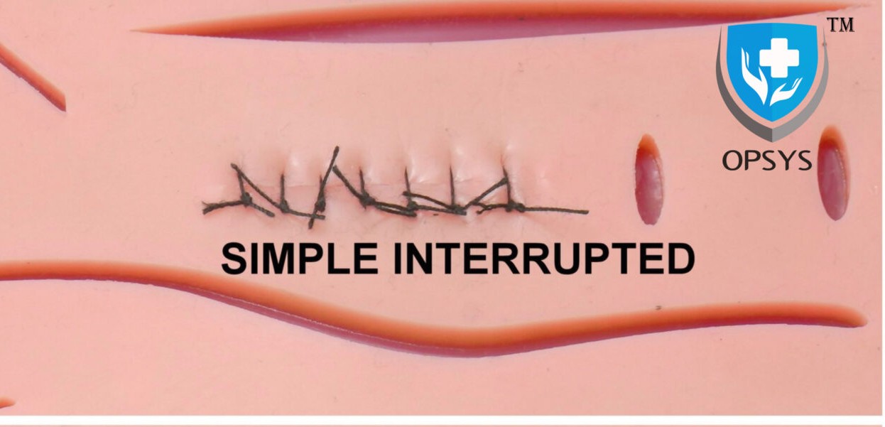 <p>What kind of suture is this?</p>