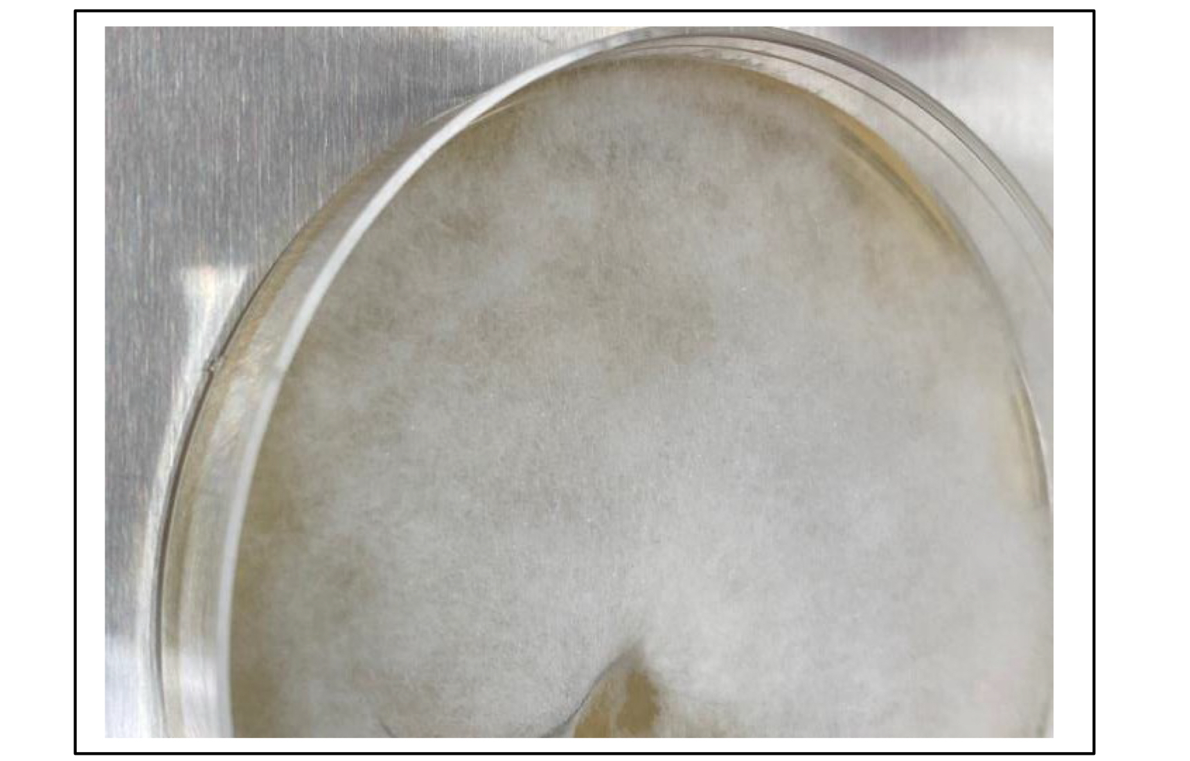 <p>Which species is this on Sabouraud dextrose agar (SAB)?</p>