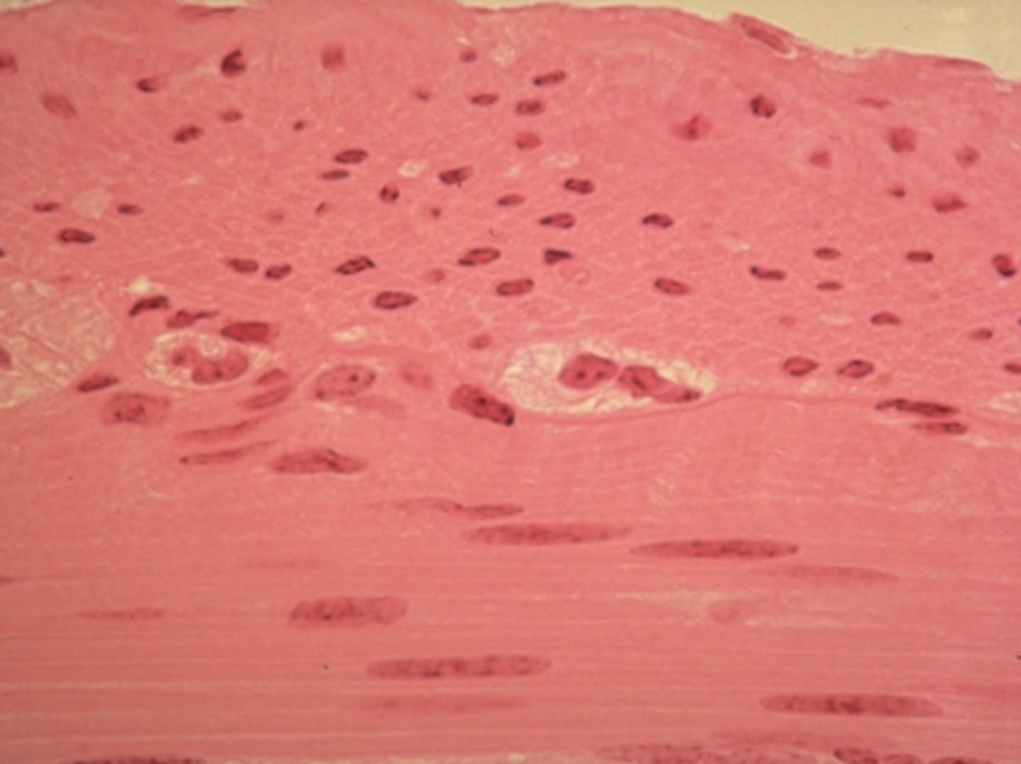 <p>Which of the four major tissue types is presented in the following image of the small intestine:</p>