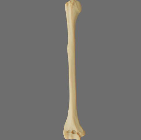 <p>What bone is this?</p>