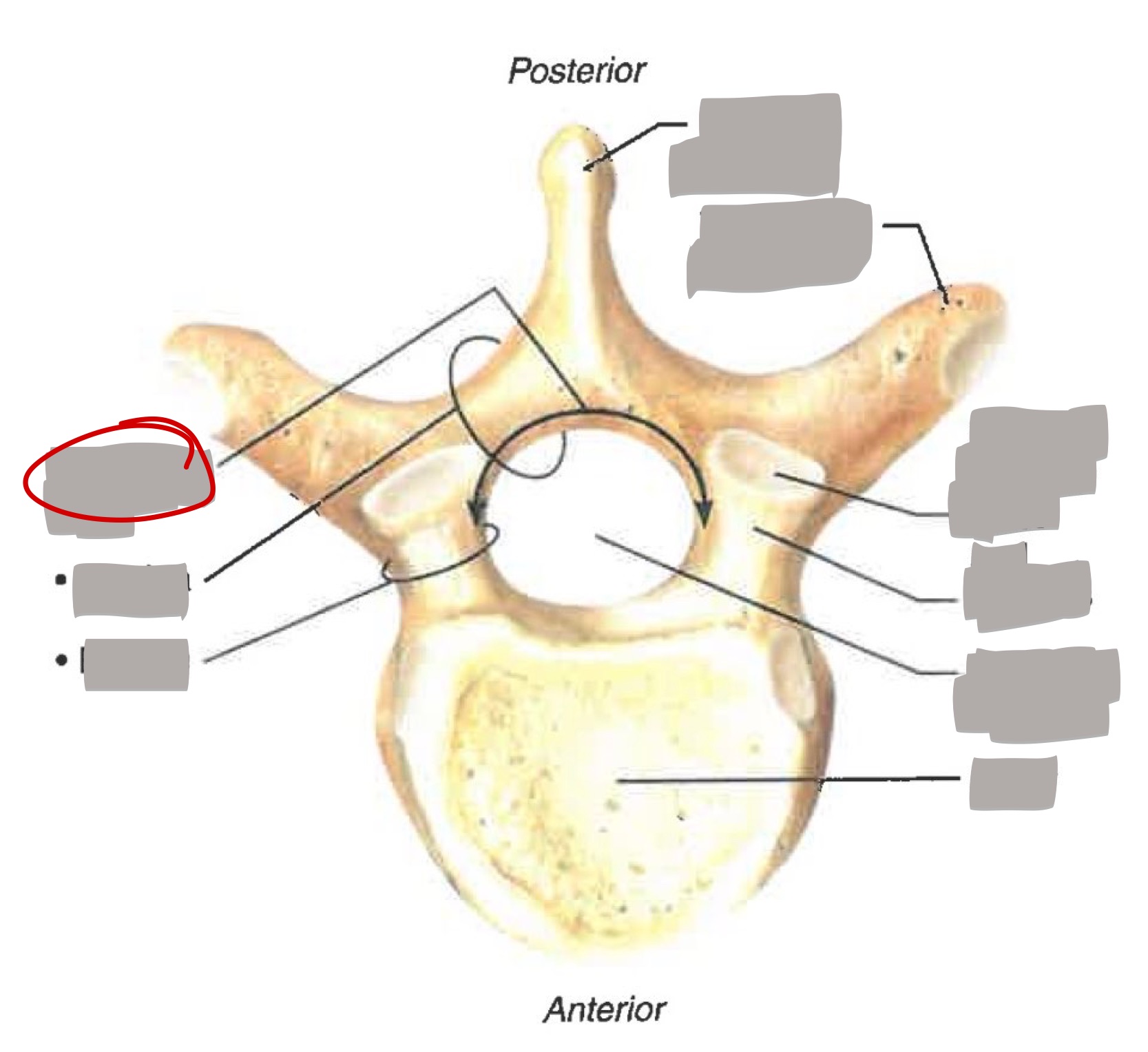 term image