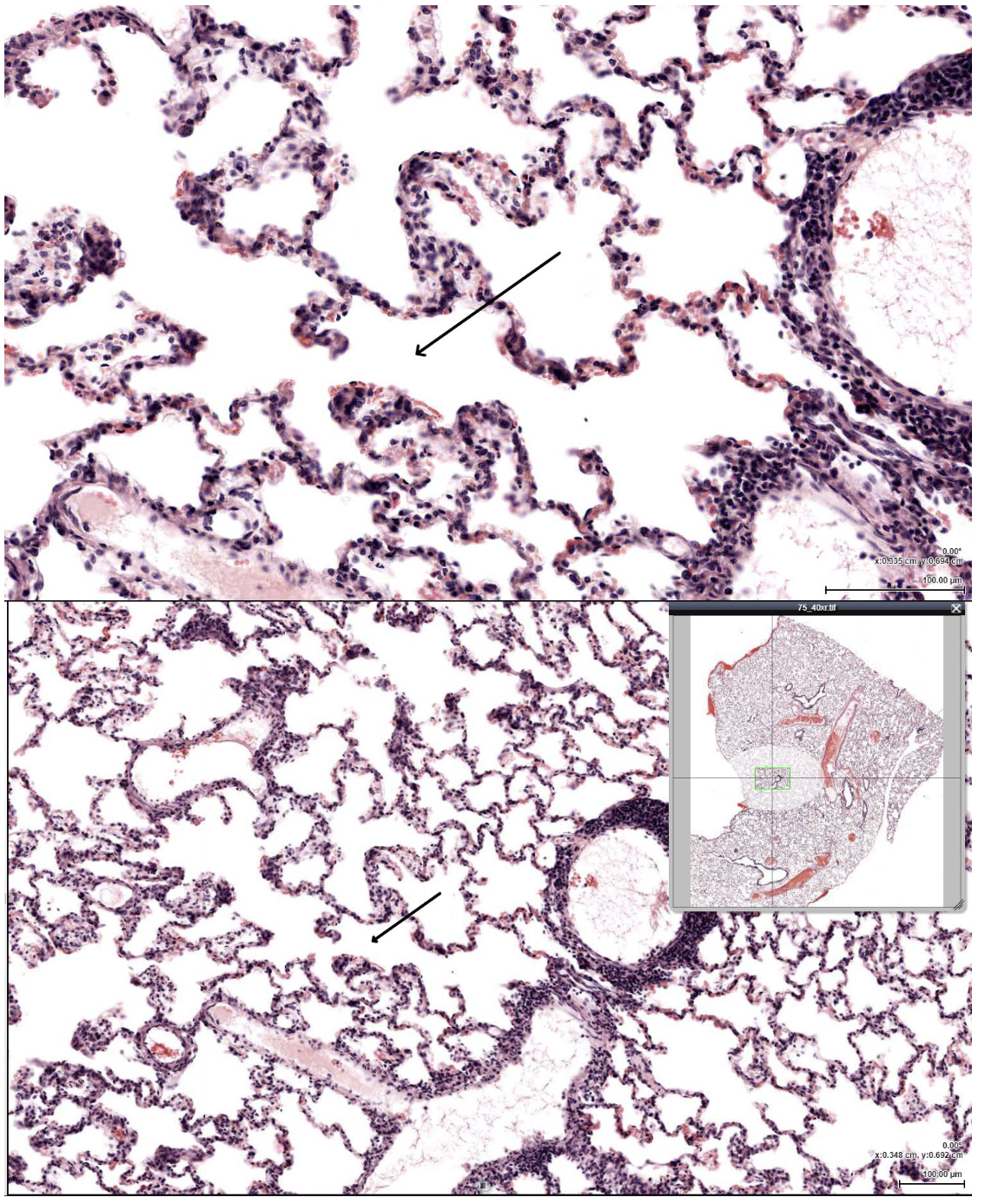 <p><span><span>After passing through the indicated structure, where would air most likely travel next?</span></span></p>