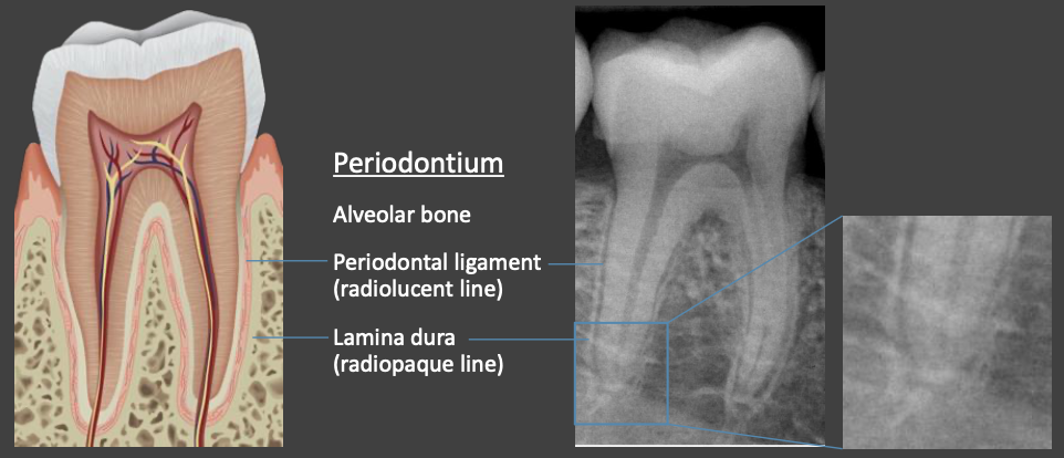 <ul><li><p>Alveolar bone</p></li><li><p>Periodontal ligament (radiolucent line)</p></li><li><p>Lamina dura</p></li></ul><p></p>