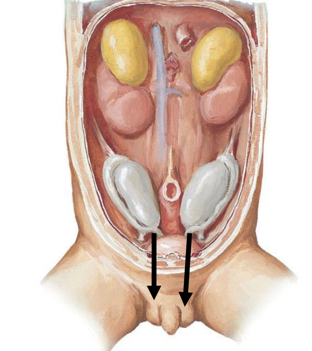 <ul><li><p>testes develop in abdomen and descend into scrotal sac through the inguinal canal at the 28th week of gestation</p></li><li><p>the inguinal canal is a passageway through lower abdominal wall that connecting the abdomen to the scrotal sac</p></li><li><p>if the testes don’t descend by age 5 they are surgically placed in scrotal sac</p></li></ul><p></p>