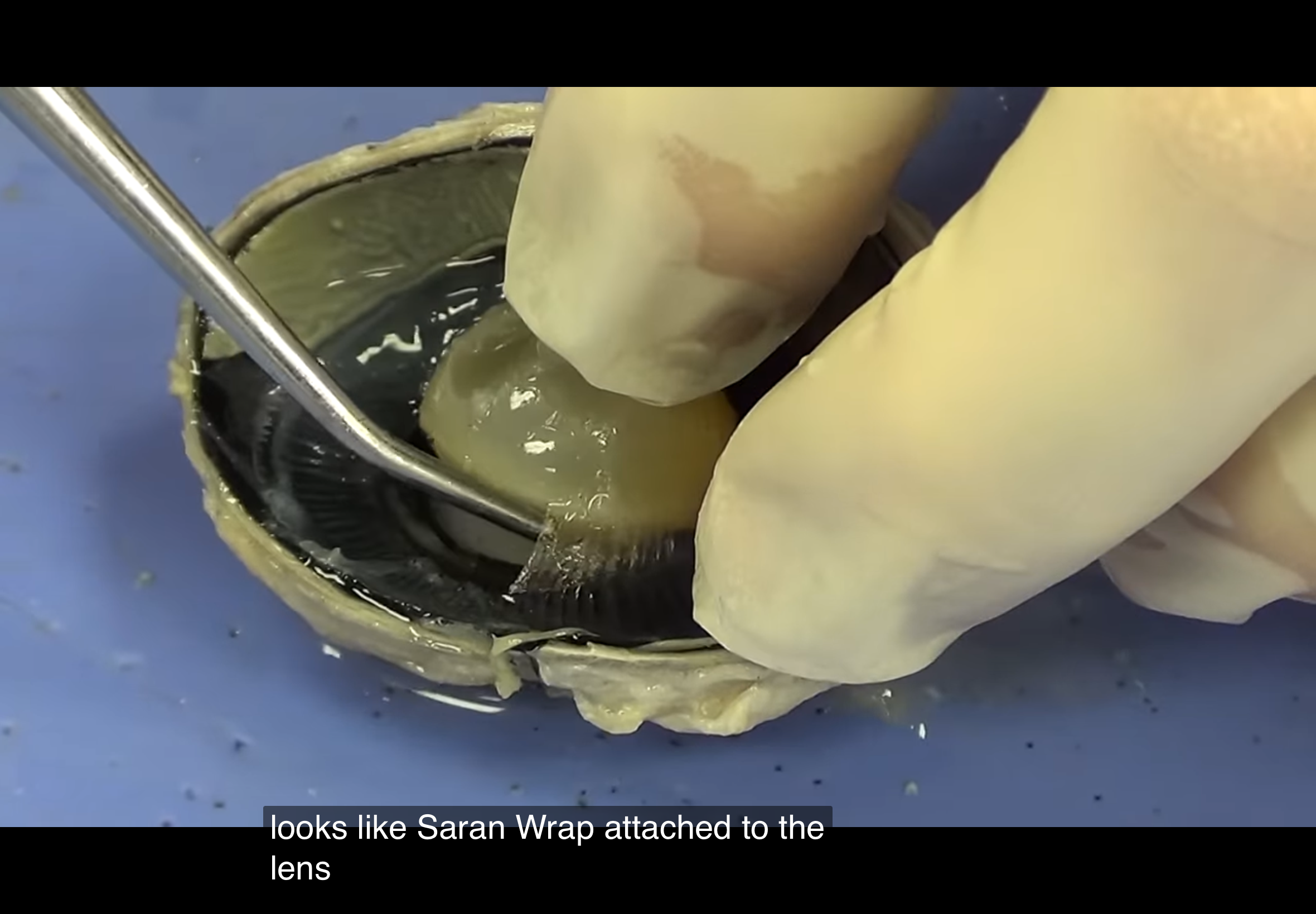 <p>Plastic looking material</p>