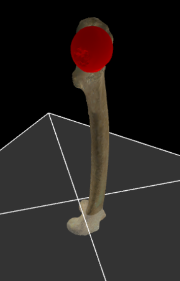 <p>Bolvormig oppervlak dat articuleert met de facies lunata van het acetabulum.</p>