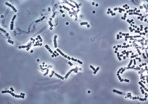 <p><span>1.</span><span style="font-size: 7pt; font-family: "Times New Roman"">&nbsp;&nbsp;&nbsp; </span><span style="font-family: "Times New Roman", serif">This corn meal-Tween 80 microscopic morphology is characteristic of the fungus (genus and species) ________________________. Note: There are no blastoconidia </span></p>