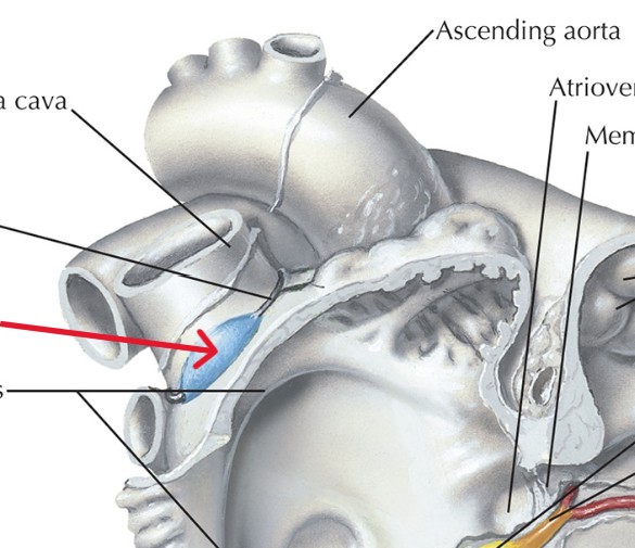 <p>Which part of the conduction system is this?</p>