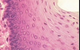 a stratified squamous epithelium that does not contain a superficial layer of dead cells (keratin). All layers including the most superficial layer of cells contain nuclei.
Provide protection and is a covering for most internal cavities of the body e.g vagina 