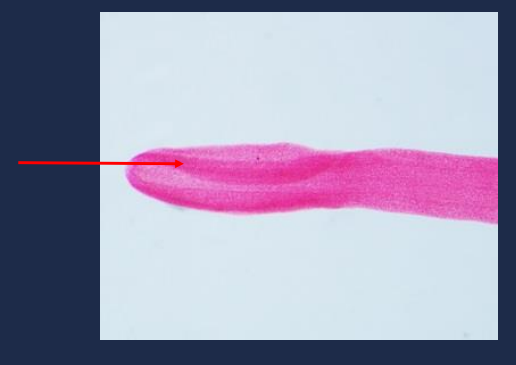 What do you call the this part of the *D latum?*