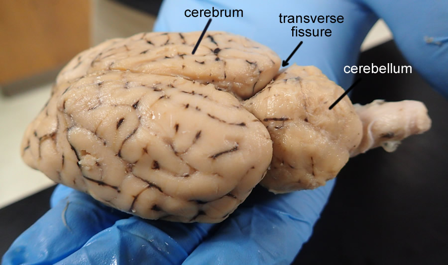 <p>separates cerebrum and cerebellum </p>