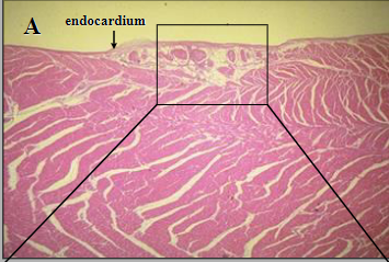 What part of the heart is this ?