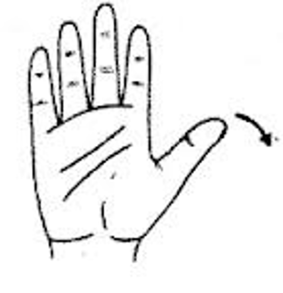 <p>Moving to its normal location or other suitable location all or a portion of a body part.</p>