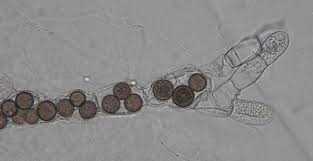 <p>Which fungi is this?</p>