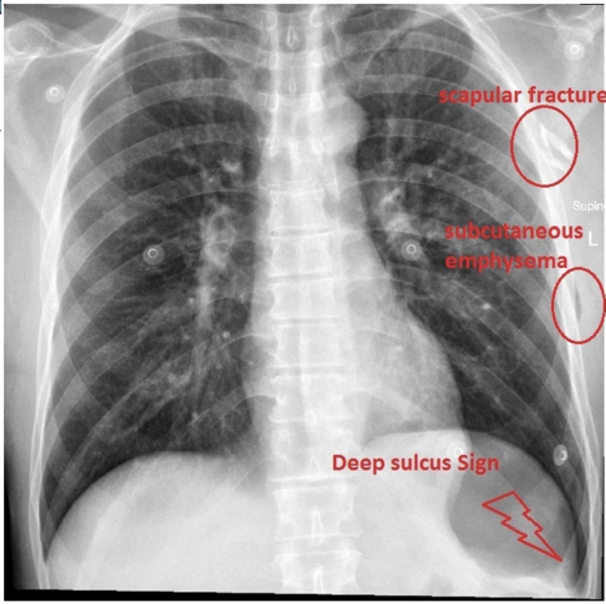 <p>ID findings in red</p>