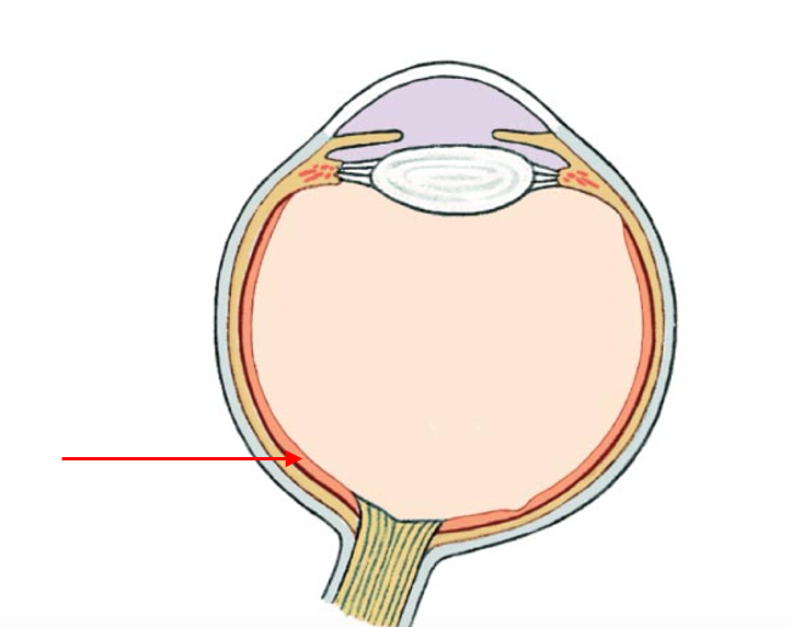 term image