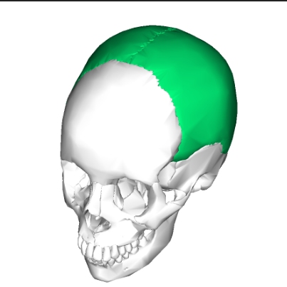 <p>(Cranium) What bone is this?</p>