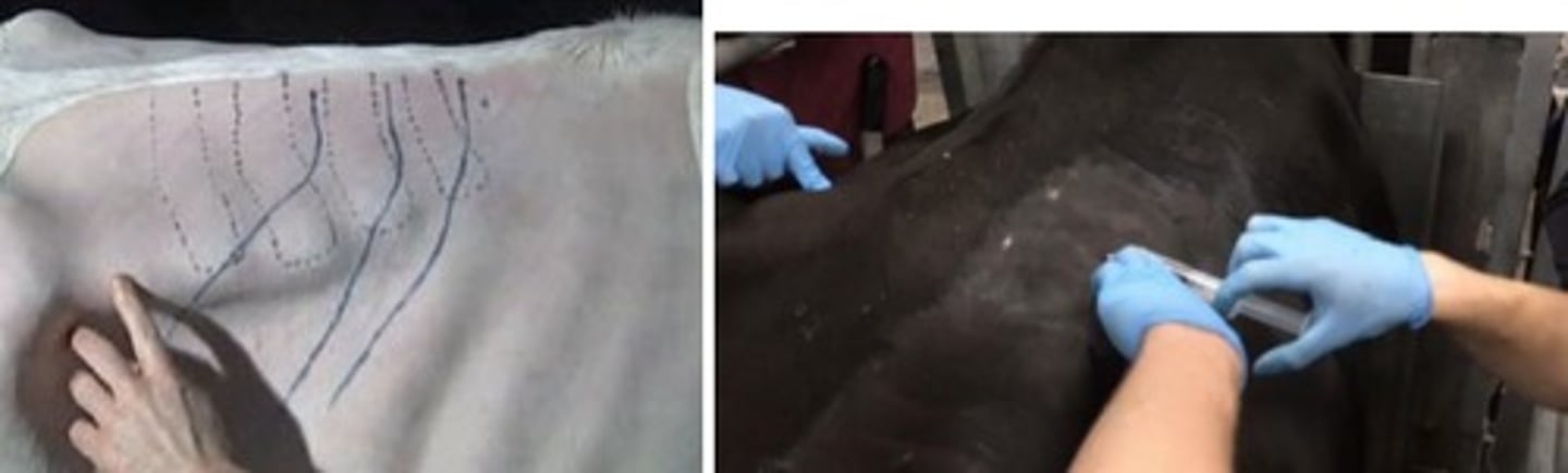 <p>subcutaneous injection on top, injecting in a fan shape about 15cm deep</p>