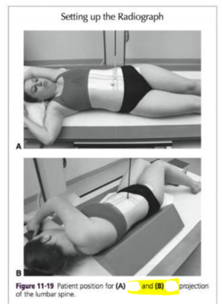 <p>What positions are these? A and B</p>