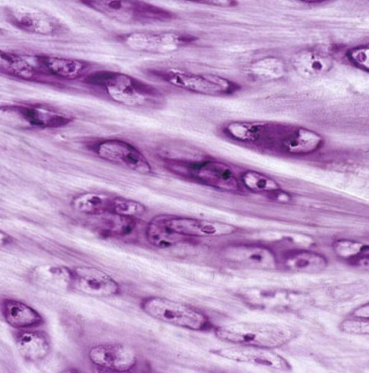 <p>filled with bundles of collagen fibers; little room for ground substance in ECM, found in the invertebrail discs</p>